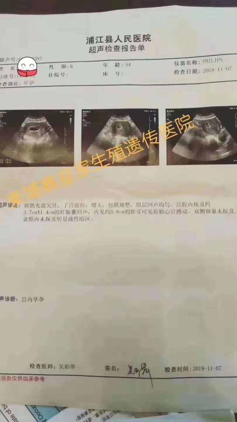 53岁做试管成功,RFG试管成功案例