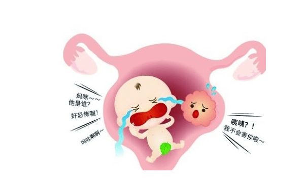 多囊卵巢综合征,多囊卵巢做试管