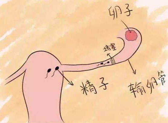34岁做试管婴儿,试管婴儿初次成功
