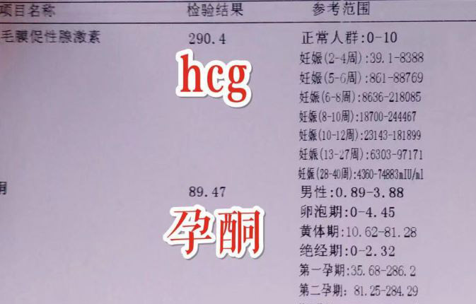 试管婴儿移植后,HCG值