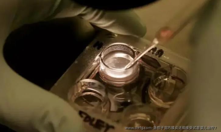 急性子宫内膜炎还能接受试管婴儿治疗？