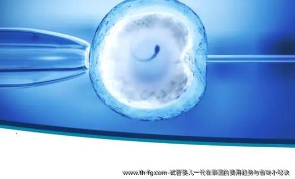 试管婴儿一代在泰国的费用趋势与省钱小秘诀 