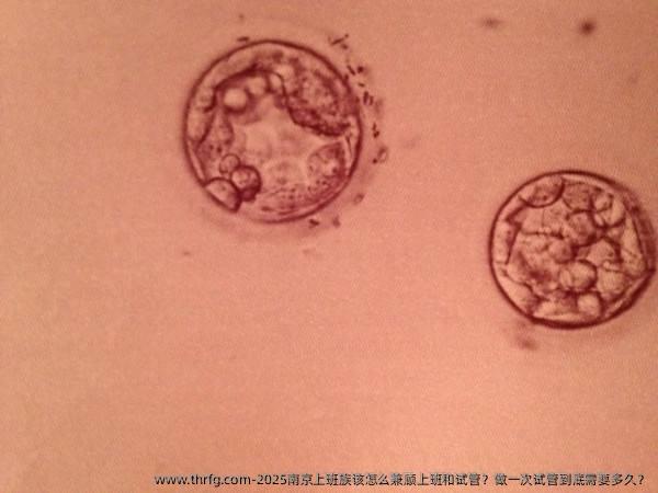 2025南京上班族该怎么兼顾上班和试管？做一次试管到底需要多久？