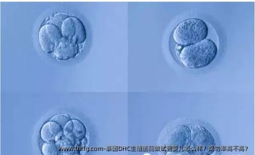 泰国DHC生殖医院做试管婴儿怎么样？成功率高不高？