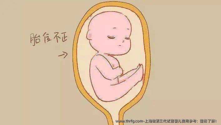 上海做第三代试管婴儿费用参考：提前了解！