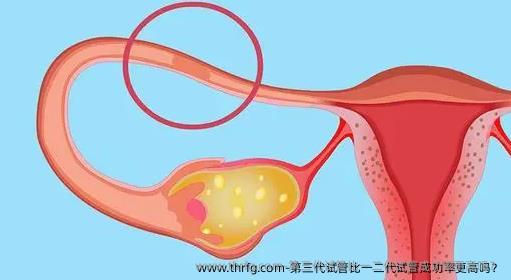 第三代试管比一二代试管成功率更高吗？