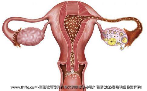 阜阳试管婴儿价格大约需要多少钱？看清2025费用明细是怎样的！