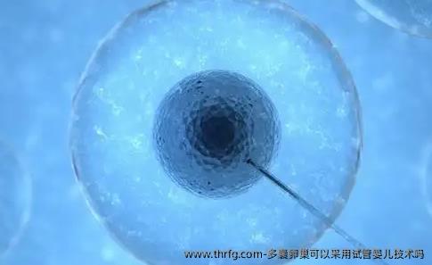 多囊卵巢可以采用试管婴儿技术吗