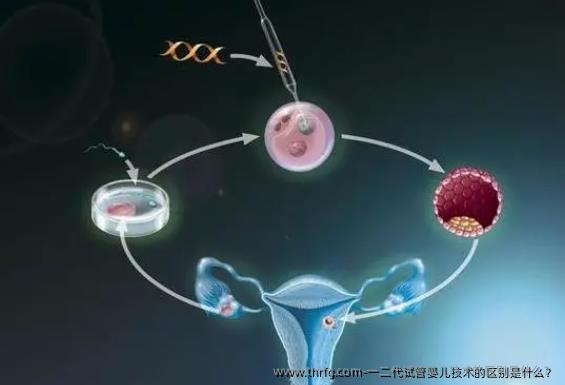 一二代试管婴儿技术的区别是什么？