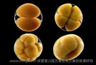 试管婴儿短方案比长方案的效果好吗