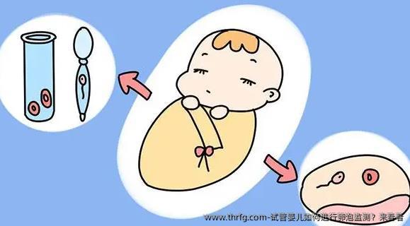 试管婴儿如何进行卵泡监测？来看看