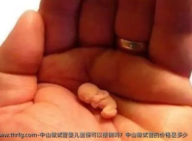 中山做试管婴儿医保可以报销吗？中山做试管的价格是多少