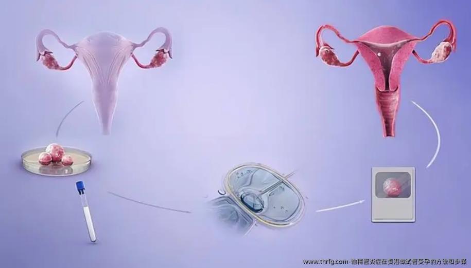 输精管炎症在贵港做试管受孕的方法和步骤