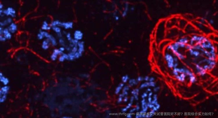 昆明爱维艾夫试管医院好不好？医院综合实力如何？