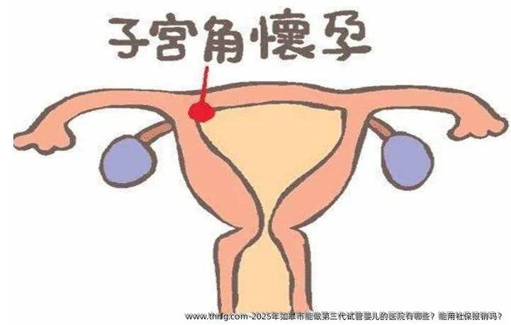 2025年如皋市能做第三代试管婴儿的医院有哪些？能用社保报销吗？