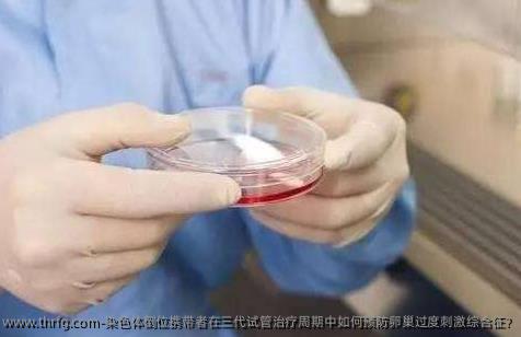 染色体倒位携带者在三代试管治疗周期中如何预防卵巢过度刺激综合征?　　