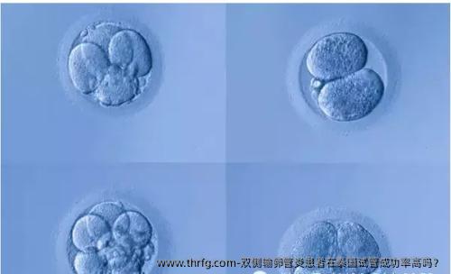 双侧输卵管炎患者在泰国试管成功率高吗？