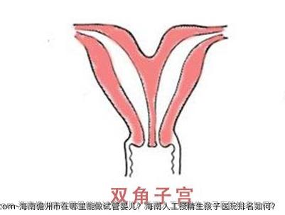 海南儋州市在哪里能做试管婴儿？海南人工授精生孩子医院排名如何？