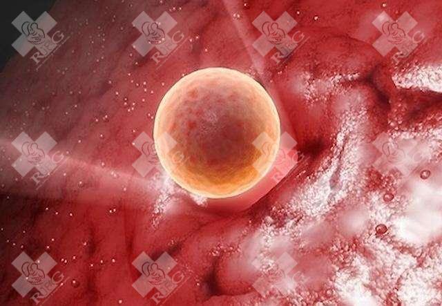 试管腹水医院怎么处理较好 试管腹水是什么意思！