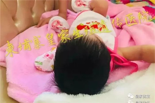 RFG试管婴儿