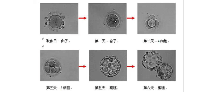 试管婴儿囊胚培养技术介绍