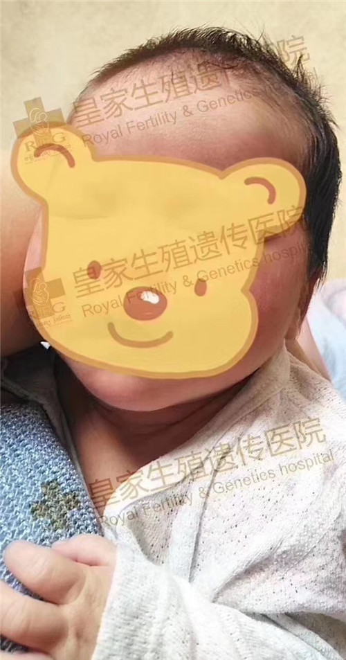 RFG好孕,RFG成功案例