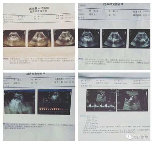 RFG试管婴儿案例