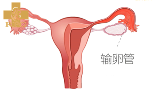 泰国试管婴儿,胚胎停育