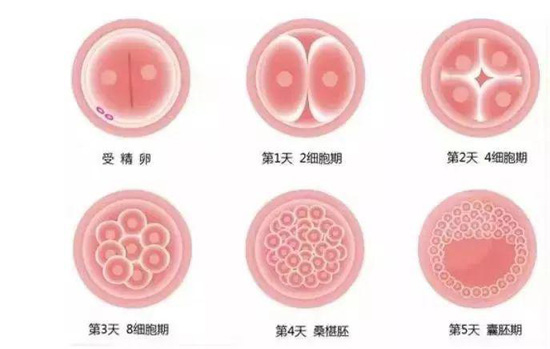 试管婴儿技术