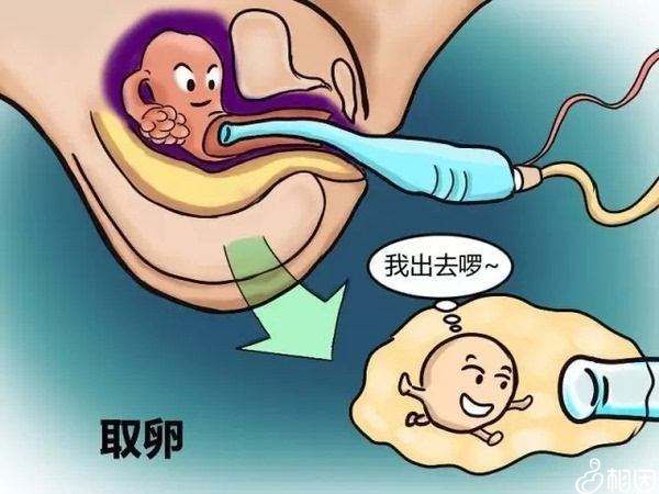 试管婴儿取卵,取卵腹水