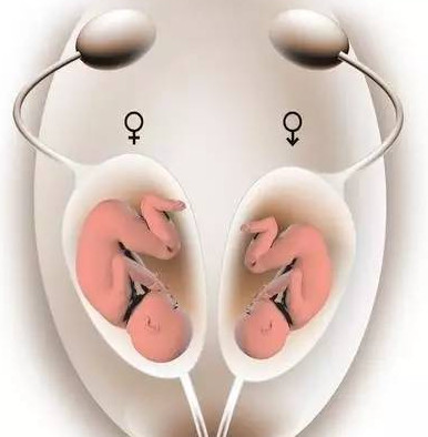胚胎放入子宫游走图片
