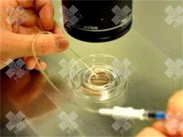 什么是二代试管？二代试管的适应人群有哪些？