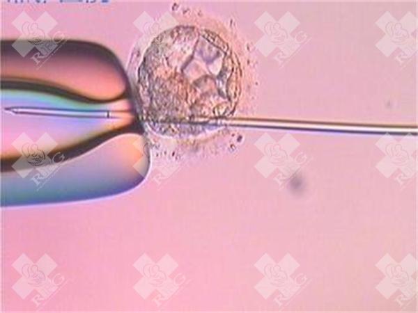 试管治疗中哪些检查需要空腹？