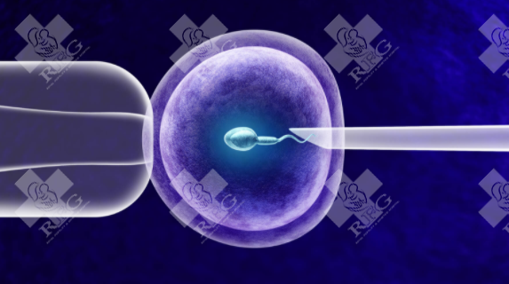 弱精症能自然受孕吗