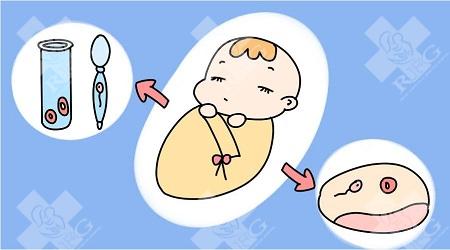 在郑州做试管哪家医院好?