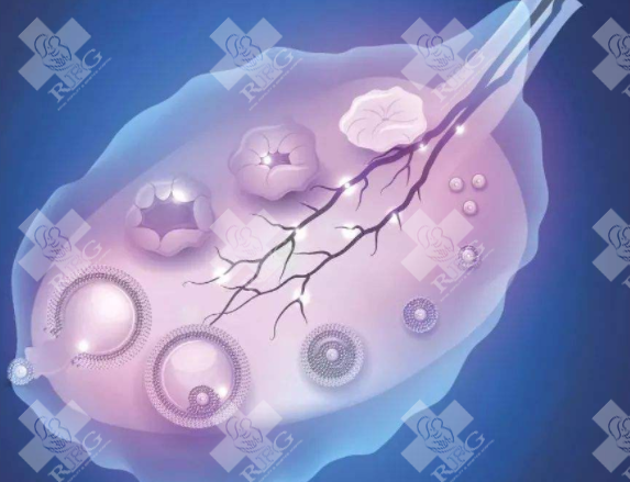 免疫性不孕的原因是什么?