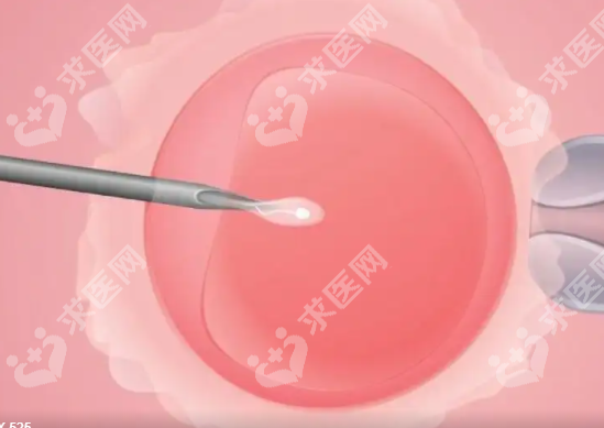湛江试管婴儿医院哪里可以做？湛江试管婴儿医院哪里好？