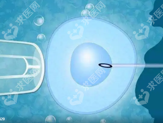 天津河东区做试管婴儿的医院有哪些？