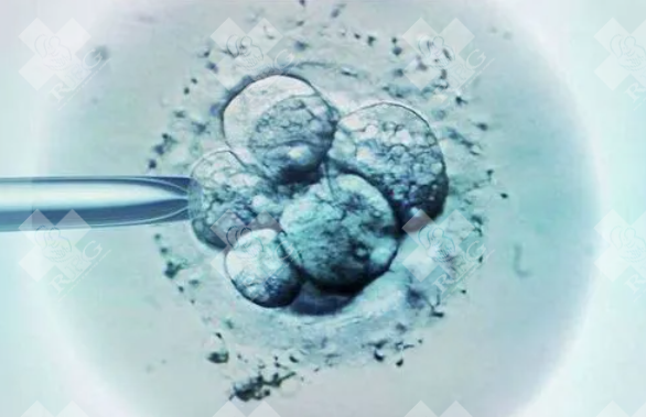 广东珠海到哪边做子宫息肉试管婴儿？