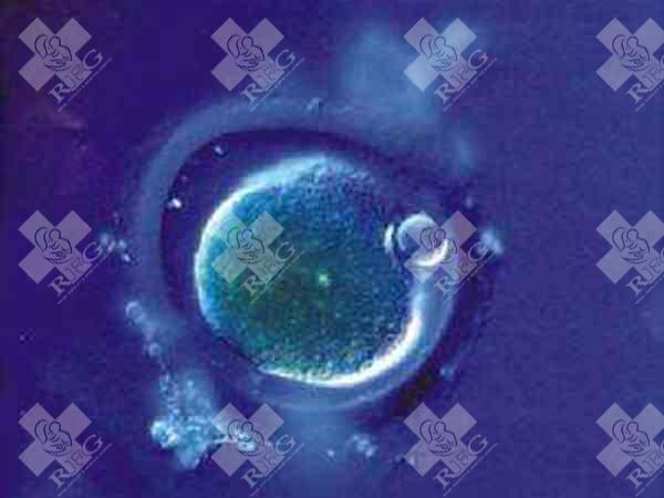 卵巢炎试管会影响胚胎着床吗？卵巢炎试管的成功率及注意事项！