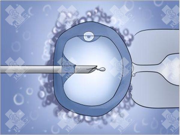 广州试管婴儿的成功率是多少?附上成功率介绍!