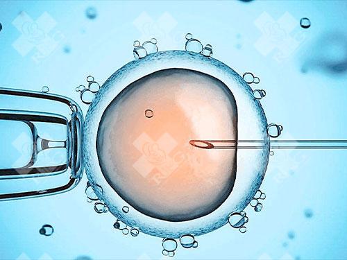 多囊卵巢综合症是什么原因导致的？