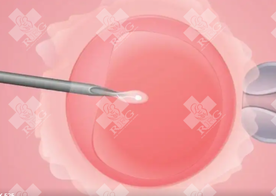 南平松溪县试管婴儿需要什么条件?