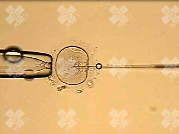 输卵管积水在梧州市中医医院做试管婴儿成功率高吗？