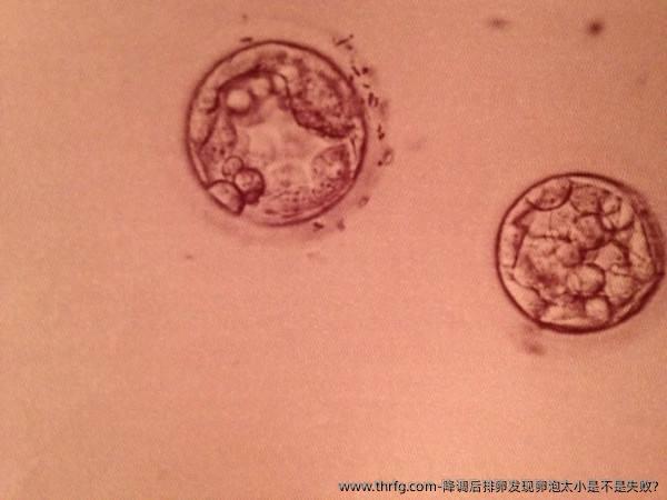 降调后排卵发现卵泡太小是不是失败?