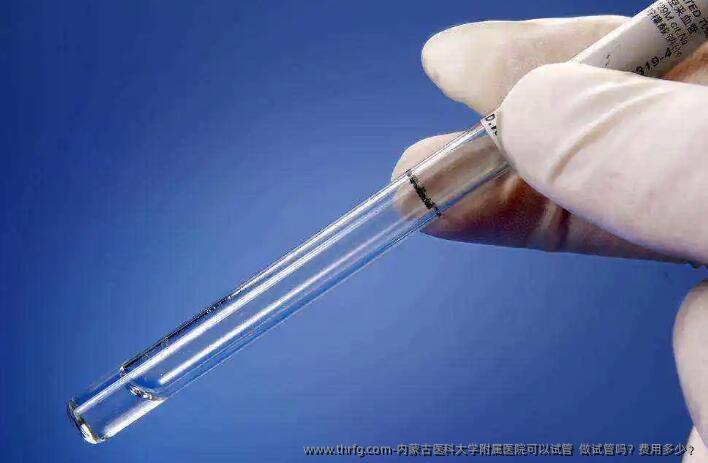 内蒙古医科大学附属医院可以试管 做试管吗?费用多少?