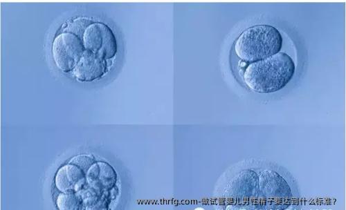 做试管婴儿男性精子要达到什么标准？