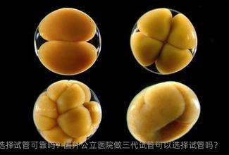 国内私立实验室做三代试管选择试管可靠吗？国外公立医院做三代试管可以选择试管吗？