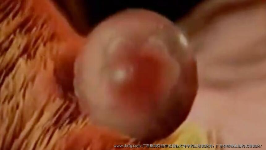 广东珠海有提供试管技术怀孕的正规医院吗?广东有哪些正规的试管医院?