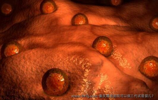 重庆哪些医院可以做三代试管婴儿？